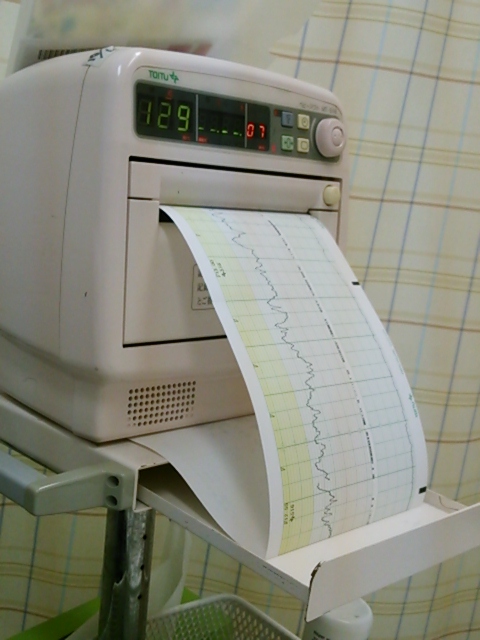 出産レポート③